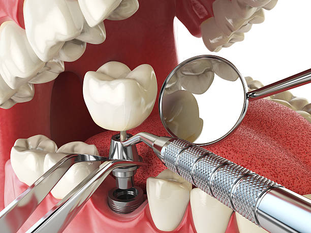 Best Cosmetic Emergency Dentistry in Braddock Heights, MD